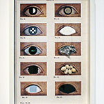 Diseases of the Eye, FIGS 24-33